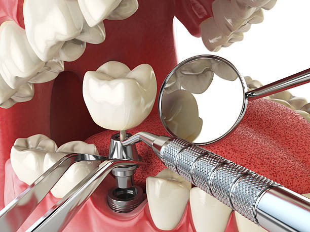 Best Emergency Dental Services for Seniors in Bethalto, IL